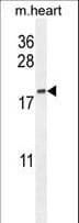 Polyclonal Rabbit anti-Human ODF3B Antibody (aa19-47, IHC, WB)