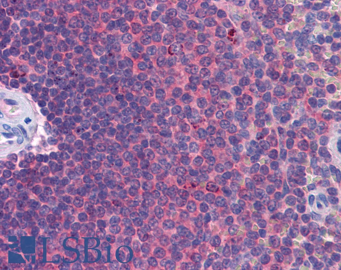IFIH1 / MDA5 Antibody (aa612-661)