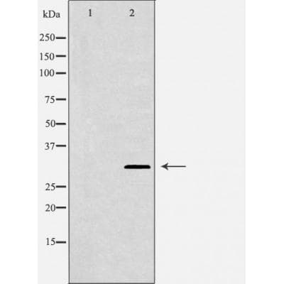 Polyclonal Rabbit anti-Human IL2RA / CD25 Antibody (p268, IF, WB)