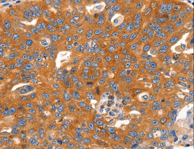 CAP2 Antibody