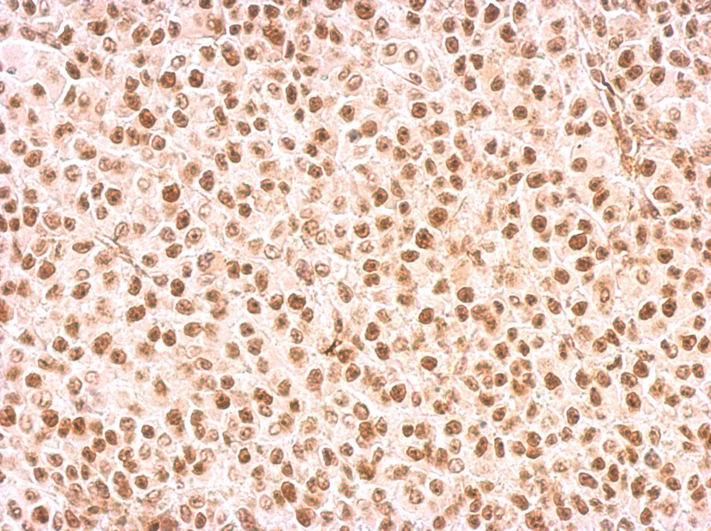 Polyclonal Rabbit anti-Human RAD9A / RAD9 Antibody (aa197-421, IHC, WB)