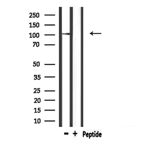 CASK Antibody