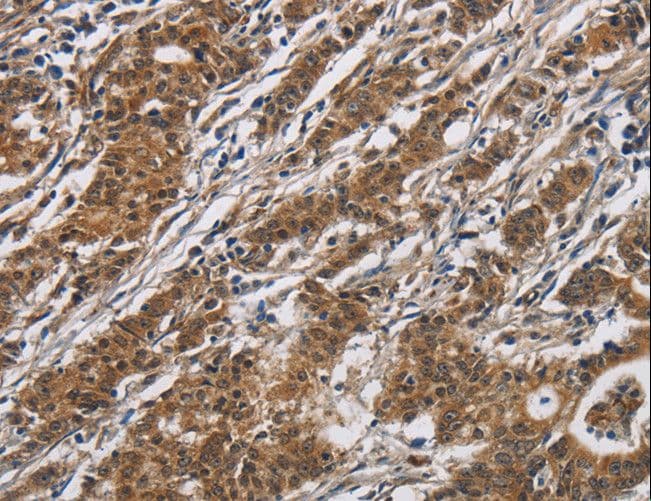 DHRS3 / SDR1 Antibody
