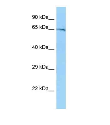 ALOX5 / 5-LOX Antibody (C-Terminus)