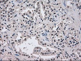 NEK6 Antibody (clone OTI5D7)