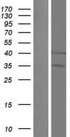 UQCC1/ UQCC Protein (Over-Expression Lysate Myc-DDK (Flag))