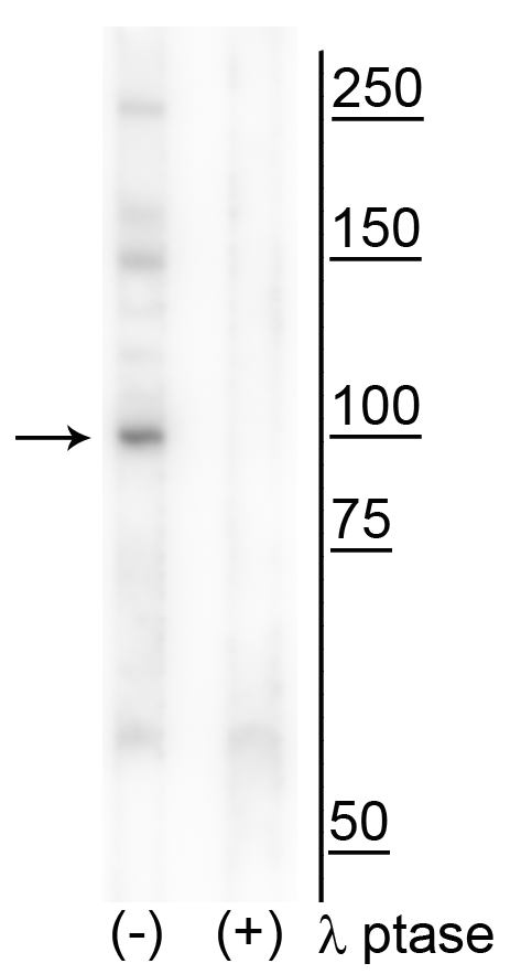 RBBP8 / CTIP Antibody (phospho-Thr847)