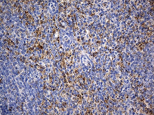 Monoclonal Mouse anti-Human CYP7B1 Antibody (clone OTI1G7, aa263-506, IHC, WB)
