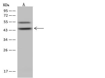 Polyclonal Rabbit anti-Human ALKBH1 / ALKB Antibody (IHC, WB)