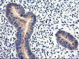 CNDP2 Antibody (clone OTI6D3)