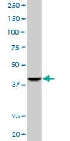 Monoclonal Mouse anti-Human ACAA1 Antibody (clone 3F11, IHC, WB)