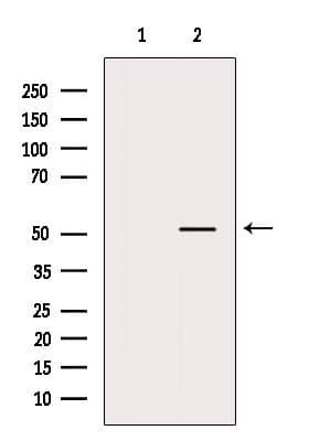 Polyclonal Rabbit anti-Human CELF2 / CUGBP2 Antibody (WB)