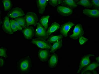 ECSCR Antibody