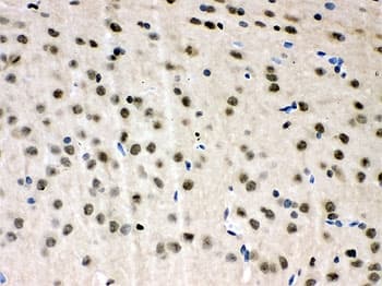 VCP Antibody (aa732-760)