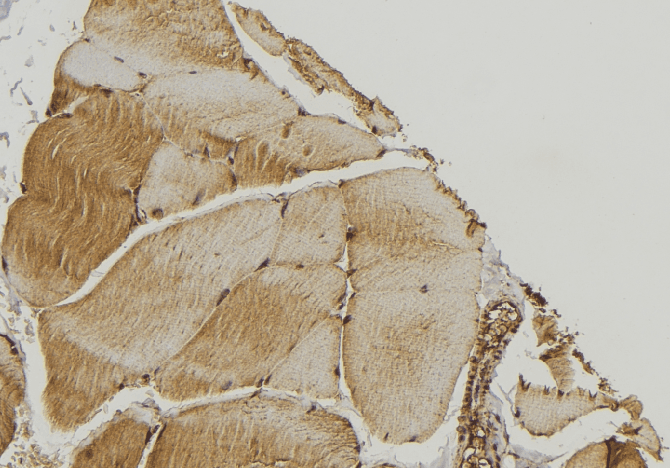 RAB7A / RAB7 Antibody