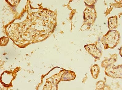 Polyclonal Rabbit anti-Human ERLIN1 / SPFH1 Antibody (IHC, WB)