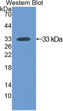 SIRT2 / Sirtuin 2 Antibody (aa28-303)