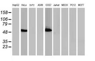 TP53 / p53 Antibody (clone OTI2H4)