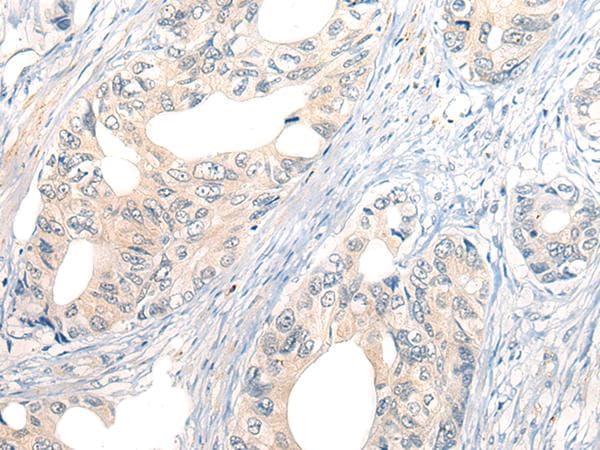 NOG / Noggin Antibody