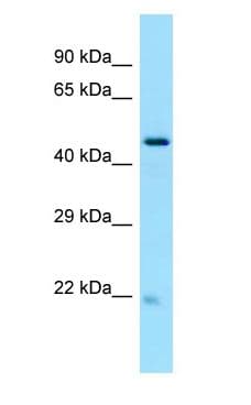 Polyclonal Rabbit anti-Human GLTSCR2 Antibody (aa380-429, WB)