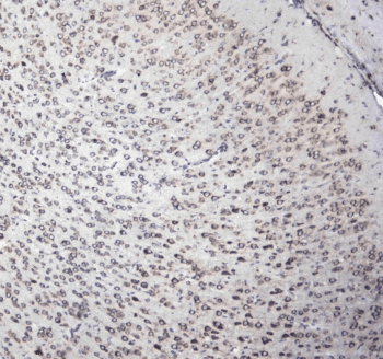 L1CAM Antibody