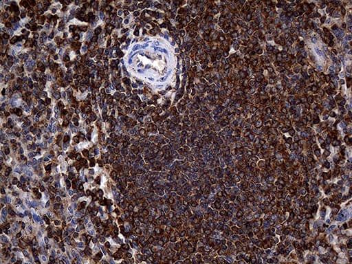 ACTR3 Antibody (aa2-418, clone OTI5G4)