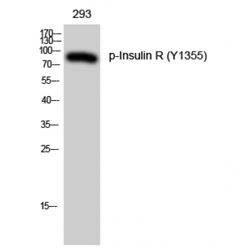 INSR / Insulin Receptor Antibody (1300-1380 aa)