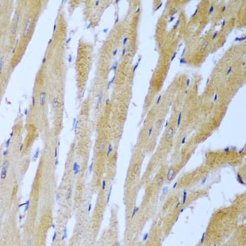 Polyclonal Rabbit anti-Human IMP-3 / IGF2BP3 Antibody (IHC, WB)