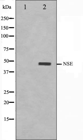 ENO2 / NSE Antibody