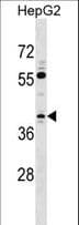TCEA3 Antibody (aa102-130)