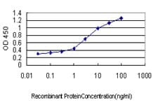 Monoclonal Mouse anti-Human ACPP / PAP Antibody (clone 2D11)
