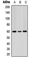 PDCD4 Antibody (N-Terminus)
