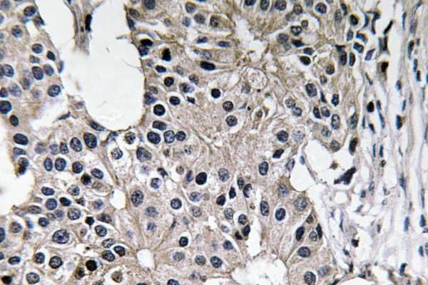CASP7 / Caspase 7 Antibody (aa45-94)