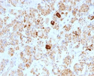 Monoclonal Mouse anti-Human LHB / Luteinizing Hormone Antibody (clone SPM103, IHC, IF)