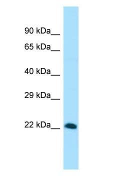 Polyclonal Rabbit anti-Human VGLL4 Antibody (aa100-149, WB)