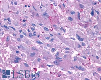 PathPlus™ GCGR / Glucagon Receptor Antibody (N-Terminus)
