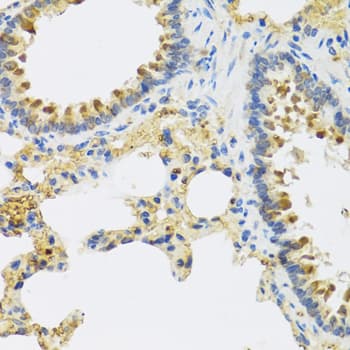 Polyclonal Rabbit anti-Human HRG Antibody (IHC, WB)