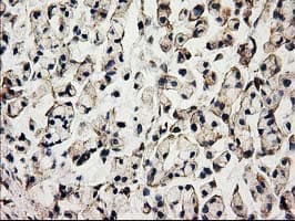 ACOT12 Antibody (clone OTI1B9)