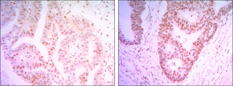CTG-B45d / THAP11 Antibody (clone 3F3)