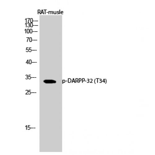 PPP1R1B / DARPP-32 Antibody (10-90 aa)