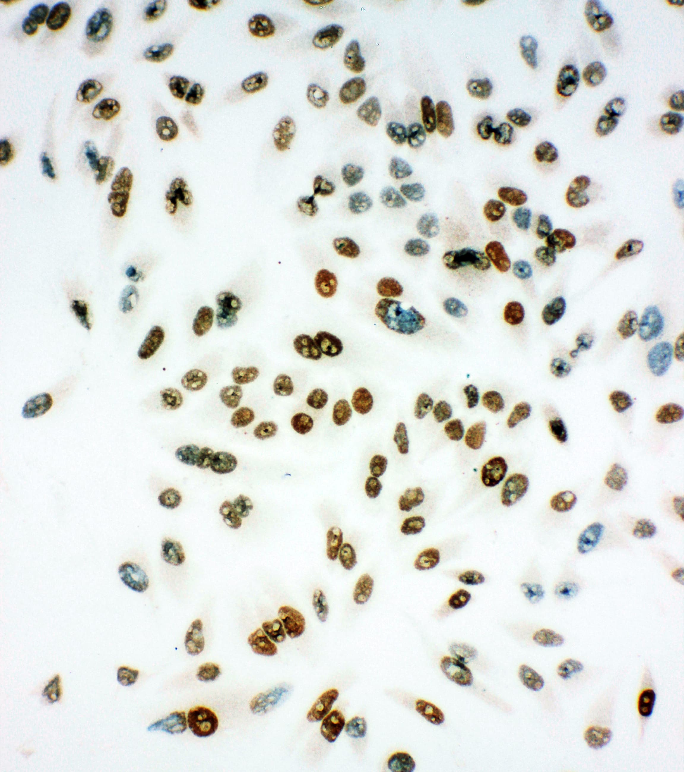 Polyclonal Rabbit anti-Human MCM6 Antibody (aa589-605, IHC, WB)
