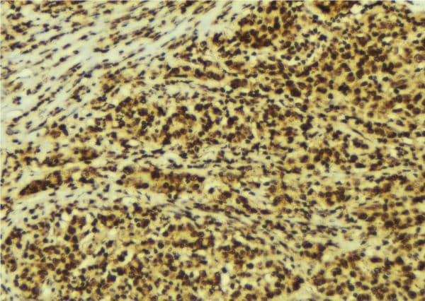 PRKAA1 / AMPK Alpha 1 Antibody