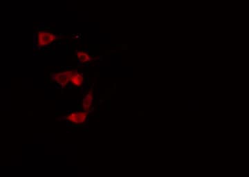Polyclonal Rabbit anti-Human DHPS Antibody (IF, WB)