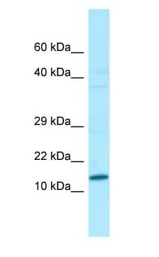 VCY Antibody (aa10-59)
