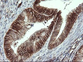 ALX4 Antibody (clone OTI6B3)