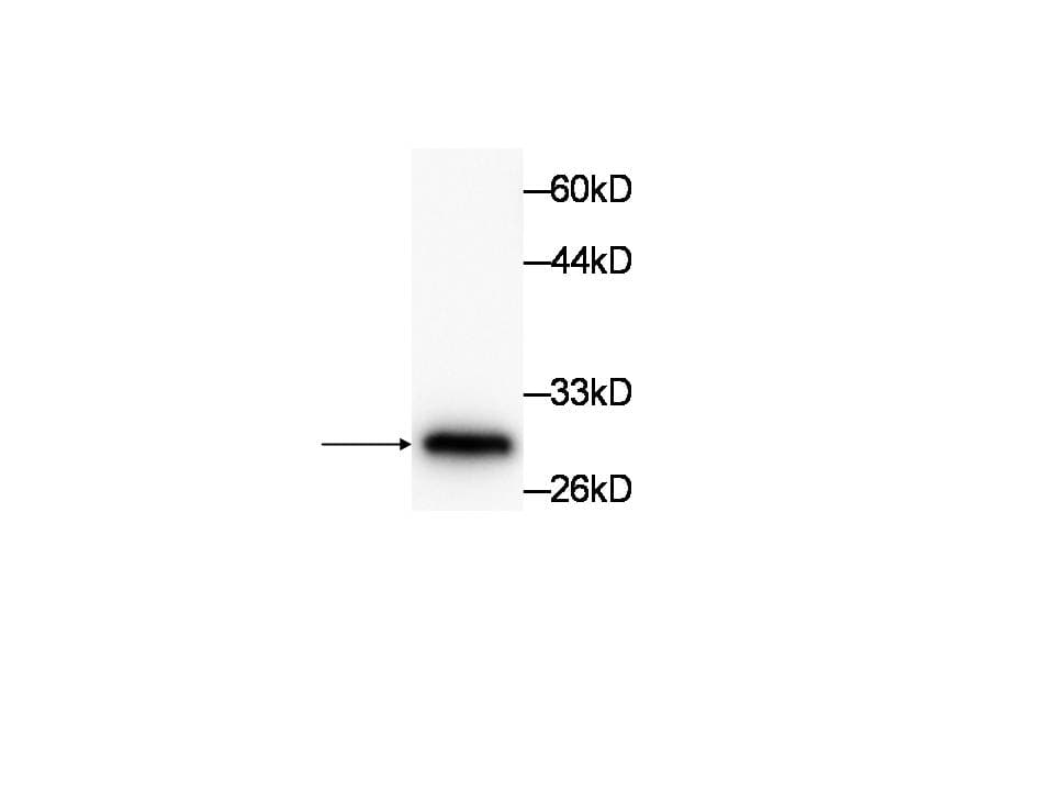 TNNI3 / Cardiac Troponin I Antibody