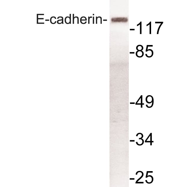 CDH1 / E Cadherin Antibody (Arg868)