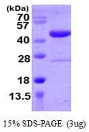 Human SPOP Protein (Recombinant His)
