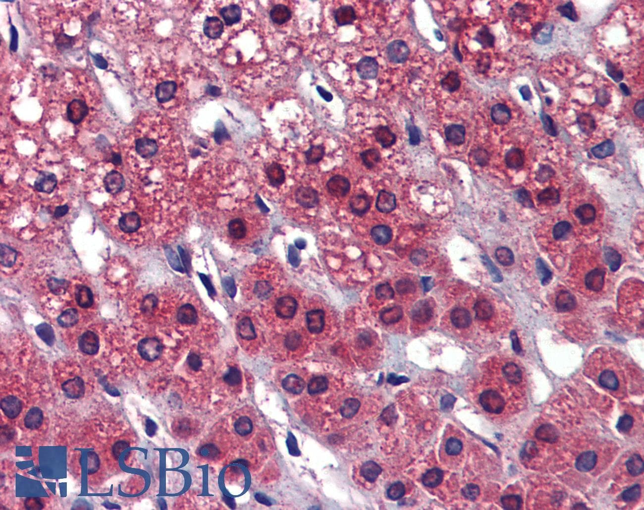 IHC-plus™ Polyclonal Rabbit anti-Human CAPS2 Antibody (IHC, IF, WB)