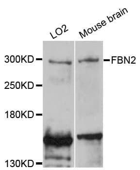 IHC-plus™ Polyclonal Rabbit anti-Human FBN2 / Fibrillin 2 Antibody (IHC, WB)